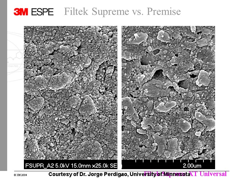 Filtek Supreme vs. Premise Courtesy of Dr. Jorge Perdigao, University of Minnesota Filtek Supreme vs. Premise Courtesy of Dr. Jorge Perdigao, University of Minnesota